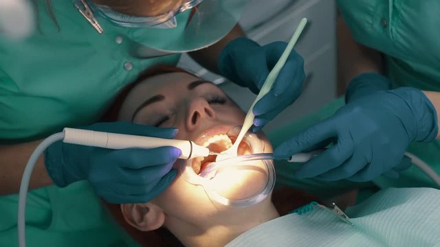 Ultrasonic cleaning of teeth. Removal of solid teeth.