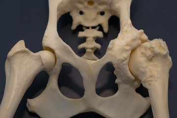 dog hip mold, normal hip and hip with arthritis
