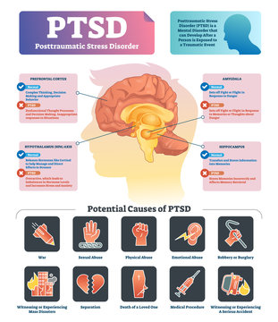 PTSD vector illustration. Labeled anatomical mental disorder causes scheme.