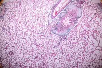 Concept of Education anatomy and Human lung tissue under microscope, The lungs is organs of the respiratory system in humans.