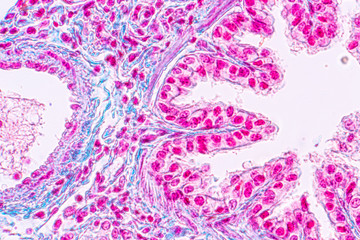 Concept of Education anatomy and Human lung tissue under microscope, The lungs is organs of the...