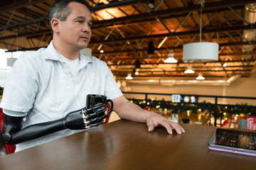 Man with robotic arm drinking coffee
