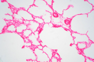 Human lung tissue under microscope view.
