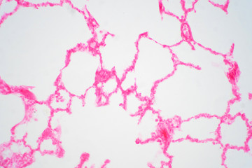 Human lung tissue under microscope view.