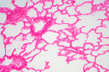 Fototapeta na wymiar Human lung tissue under microscope view.