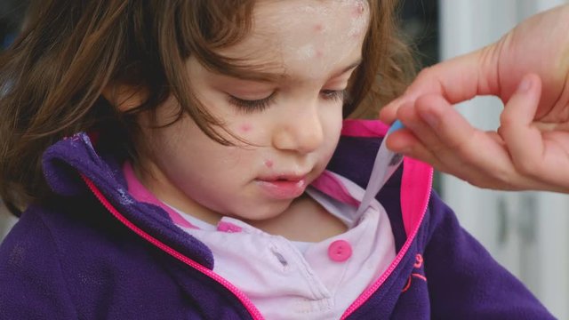 take child temperature fever with thermometer chicken pox varicella disease