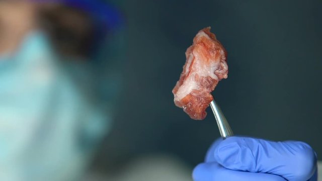 Lab assistant holding meat sample in forceps, product quality analysis, export