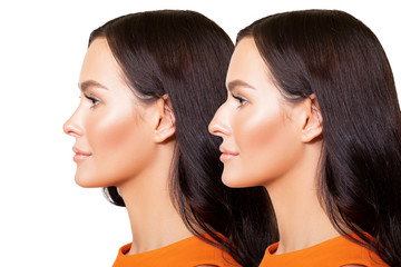 Comparison of Female nose after plastic surgery. portrait of beautiful caucasian young woman in profile is isolated on white background - Image. 