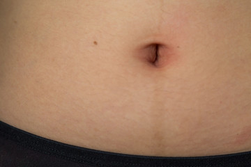 navel of the stomach of woman
