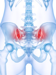 3d rendered medically accurate illustration of a painful sacroiliac joint
