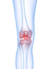 3d rendered medically accurate illustration of a painful knee