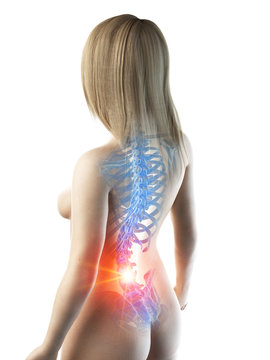 3d rendered medically accurate illustration of a painful back
