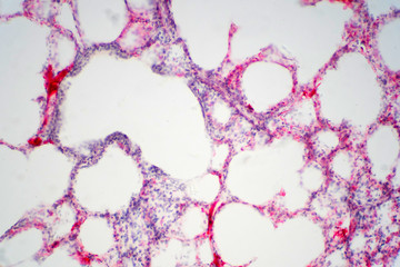 Human lung tissue under microscope view.