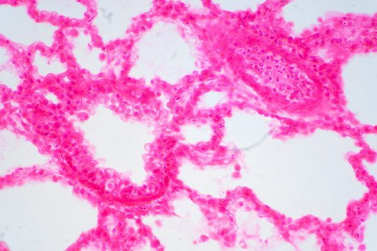 Human lung tissue under microscope view.