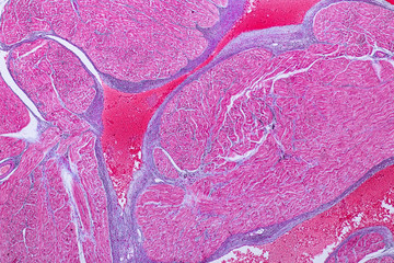 Education anatomy and Histological sample Heart muscle Tissue under the microscope.