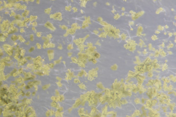 Close up of Aspergillus oryzae is a filamentous fungus, or mold that is used in food production, such as in soybean fermentation for education in laboratory.(soft focus and have Grain/Noise)