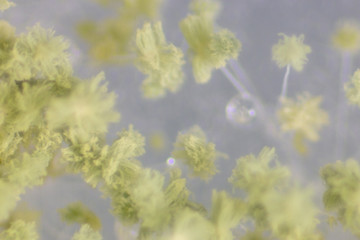 Close up of Aspergillus oryzae is a filamentous fungus, or mold that is used in food production, such as in soybean fermentation for education in laboratory.(soft focus and have Grain/Noise)