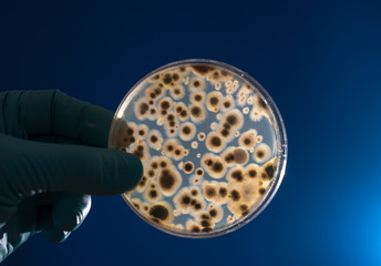 petri dish with microbe colony in doctor hand