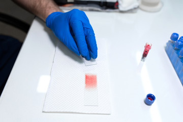 scientist prepare blood sample for research on microscope. Placing blood sample on microscope slide