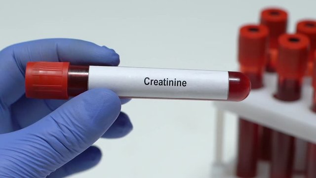 Creatinine, doctor holding blood sample in tube close-up, health check-up