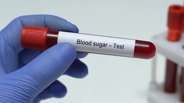 Blood Sugar-Test, doctor holding blood sample in tube close-up, health check-up