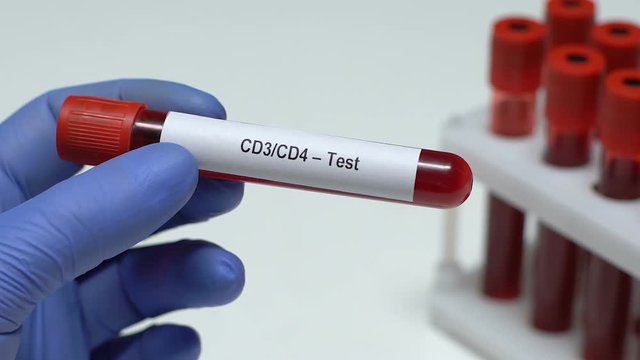 CD3 CD4-Test, doctor holding blood sample in tube close-up, health check-up