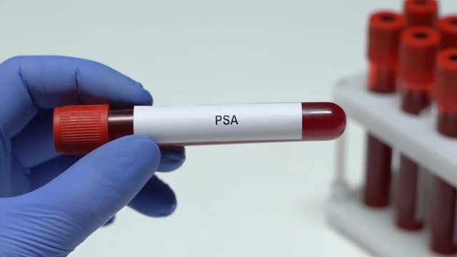 PSA, laboratory worker holding blood sample in tube close-up, health check-up
