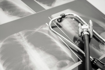 x-ray of the lungs with stethoscope on the table. radiograph with copyspace. 