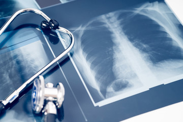 x-ray of the lungs with stethoscope. concept lung disease.