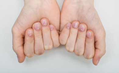 Obraz na płótnie Canvas Nail Care And Manicure Of Beautiful Female Hands