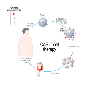 CAR T cell therapy. cancer immunotherapy. Artificial leukocyte receptors