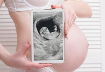 Pregnant woman in underwear holding and showing digital tablet with fetal ultrasound photo on white wooden background. Close-up