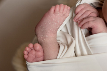 Feet of a newborn baby, toes, hands and nails of a child, the first days of life after birth, scaly skin