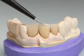 Work on tooth crown in dental laboratory