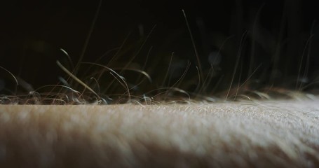 Slow motion macro of hair raising goose bumps on man arm skin caused by some strong emotions.
