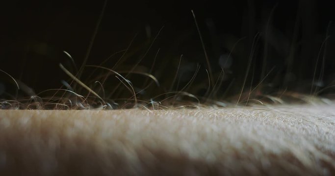 Slow motion macro of hair raising goose bumps on man arm skin caused by some strong emotions.