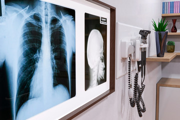 doctor office or examination room  x ray on the wall in a hospital. Medical healthcare background.