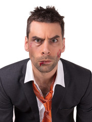 Close up of a businessman with bloody lip, beaten and bruised