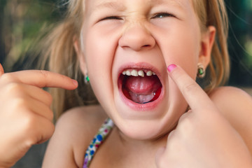 Little girl points the finger at a wobbly baby tooth