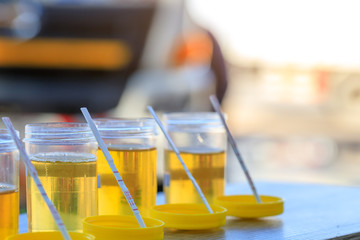 Amphetamine Testing for Substance Abuse Treatment in Urine.