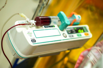 Blood in syringe pump machine transferring blood to a sick newborn baby in a hospital.