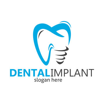 dental braces logo, dental implant, dental logo design