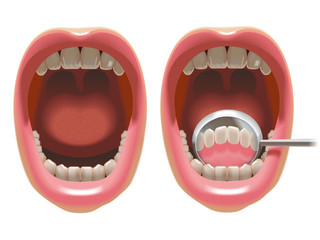 デンタルミラーで前歯の裏を見る