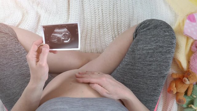 Pregnant woman holding ultrasound image. Concept of pregnancy. Top view