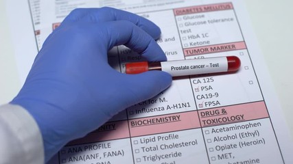 Prostate cancer, doctor checking diseases in lab blank, showing blood sample