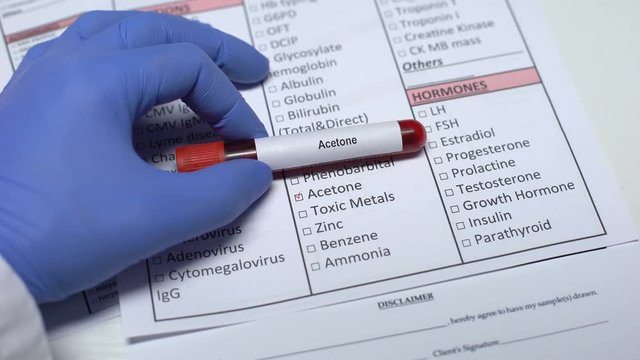 Acetone, doctor checking disease in lab blank, showing blood sample in tube