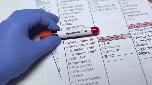 Mycoplasma, doctor checking disease in lab blank, showing blood sample in tube
