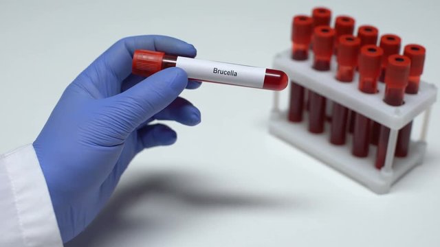 Brucella, doctor showing blood sample in tube, lab research, health checkup