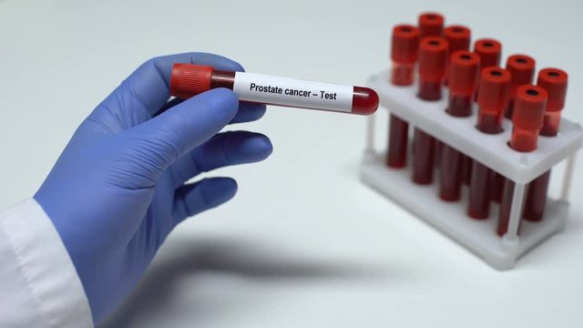 Prostate cancer, doctor shows blood sample in tube, lab research, health checkup