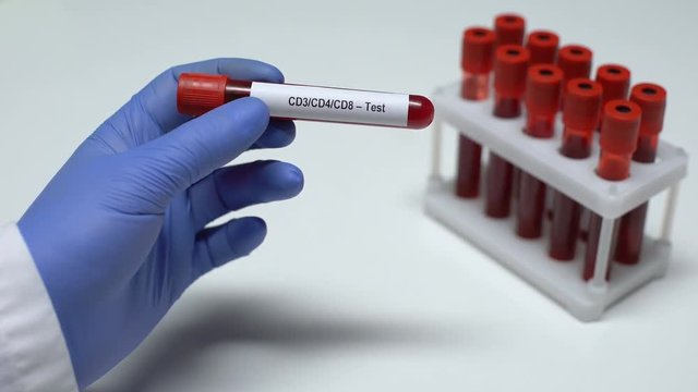CD3 CD4 CD8, doctor showing blood sample in tube, lab research, health checkup